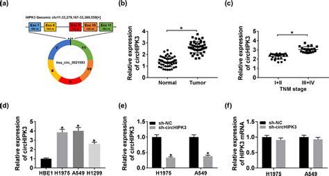 Circhipk Was Highly Expressed In Lung Cancer A Schematic