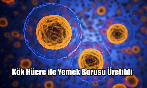 Kök Hücre ile Yemek Borusu Üretildi Bilim Ve Tekno