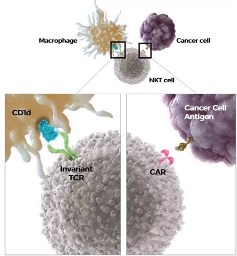 新型car Nkt细胞免疫疗法治疗实体瘤锋芒初现全球肿瘤医生网