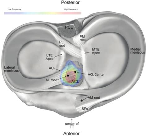 The Native Insertion Of The Anterior Root Of The Lateral Meniscus Download Scientific Diagram