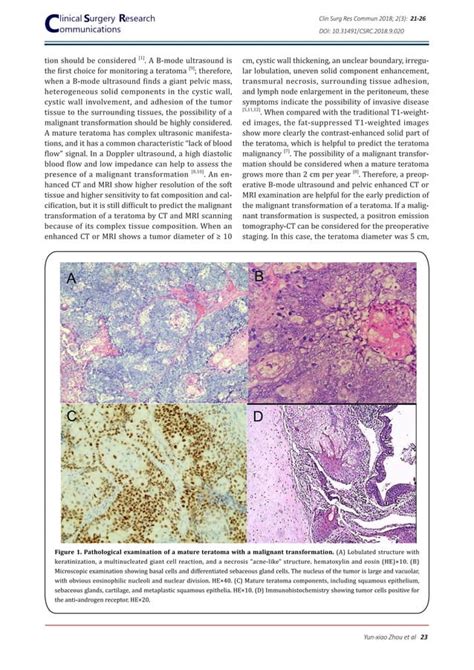 Malignant Transformation Of A Mature Ovarian Teratoma A Case Report