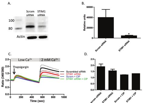 Stromal Interaction Molecule 1 STIM1 Knockdown Attenuates