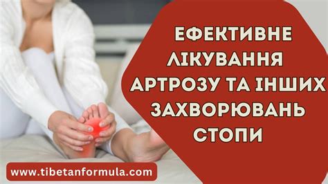 Ефективне лікування артрозу та інших захворювань стопи - YouTube