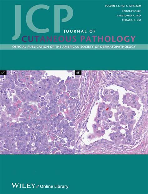 Journal Of Cutaneous Pathology Wiley Online Library