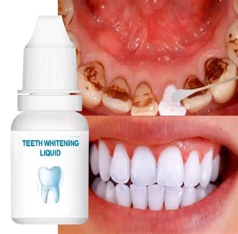 Teeth Whitening Serum Gel Dental Oral Hygiene Effective Remove Stains