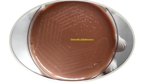 Chocolate Agar Introduction Composition Principle Preparation