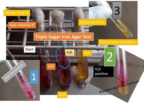 Triple Sugar Iron agar (TSI) Test: Introduction, Principle, procedure, Result , Interpretation ...