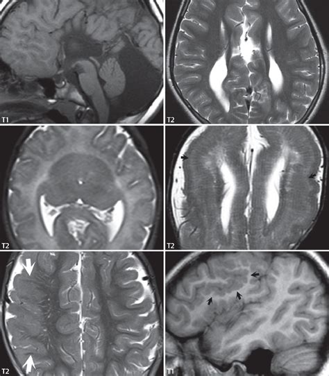 Congenital Malformations Radiology Key