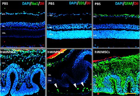 Immunoreactivity Of Iba1 Ed1 And Gfap In The Retina After Hwjmscs