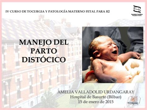 Pdf Manejo Del Parto DistÓcico Amelia Valladolid Urdangaray Hospital