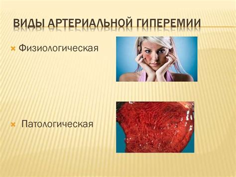 Артериальная гиперемия - презентация онлайн