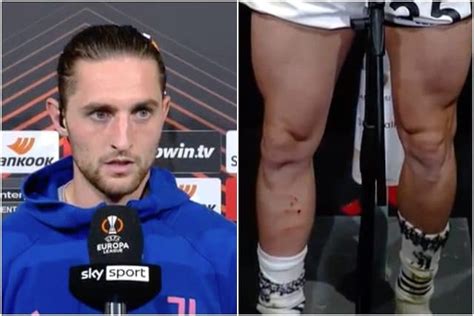 Rabiot Incredulo In Diretta Tv Dopo Il Rigore Negato Alla Juve Mostra