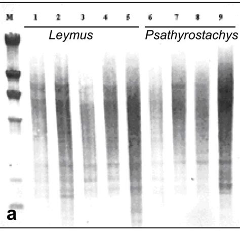 A Luminograph Showing Southern Genomic Hybridization Using Ecl