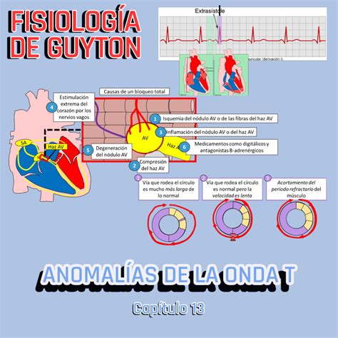 PRESENTACIÓN COMPLETA l Fisiología de Guyton l CAP 13 Arritmias