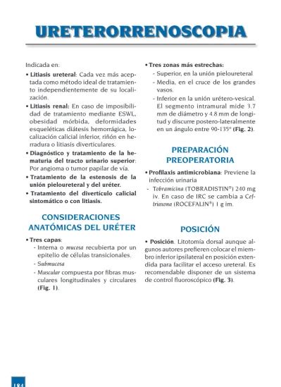 Ureterorrenoscopia Preparaci N Preoperatoria Consideraciones Anat Micas