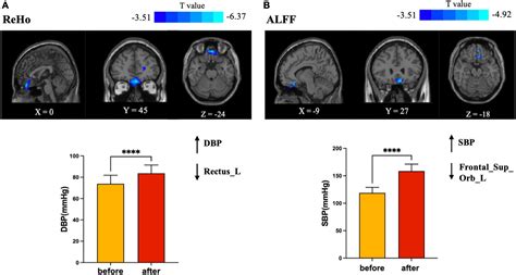 Frontiers Altered Spontaneous Brain Activity During Dobutamine