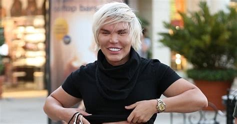 Human Ken Doll Shows Off Surgically Enhanced Stomach