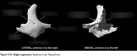 Anth Quiz Zygomatic Bone Diagram Quizlet