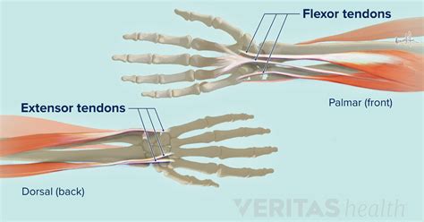 Wrist Tendonitis An Overview Wrist Tendonitis Tendinitis Ligaments