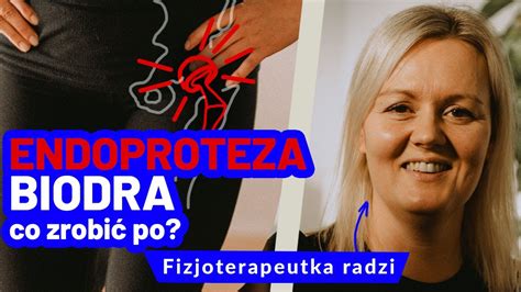 Endoproteza biodra wszystko co musisz wiedzieć o postępowaniu po