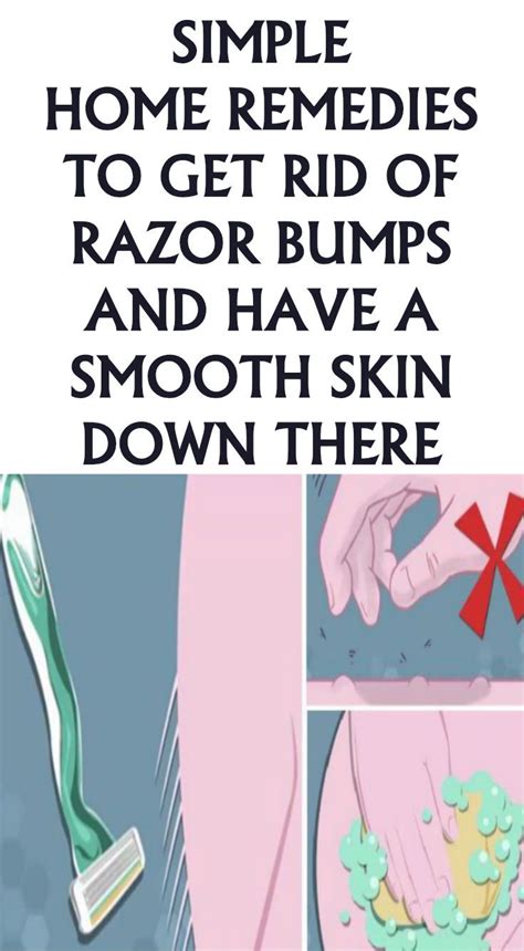 Razor Bumps Remedy Boolimg