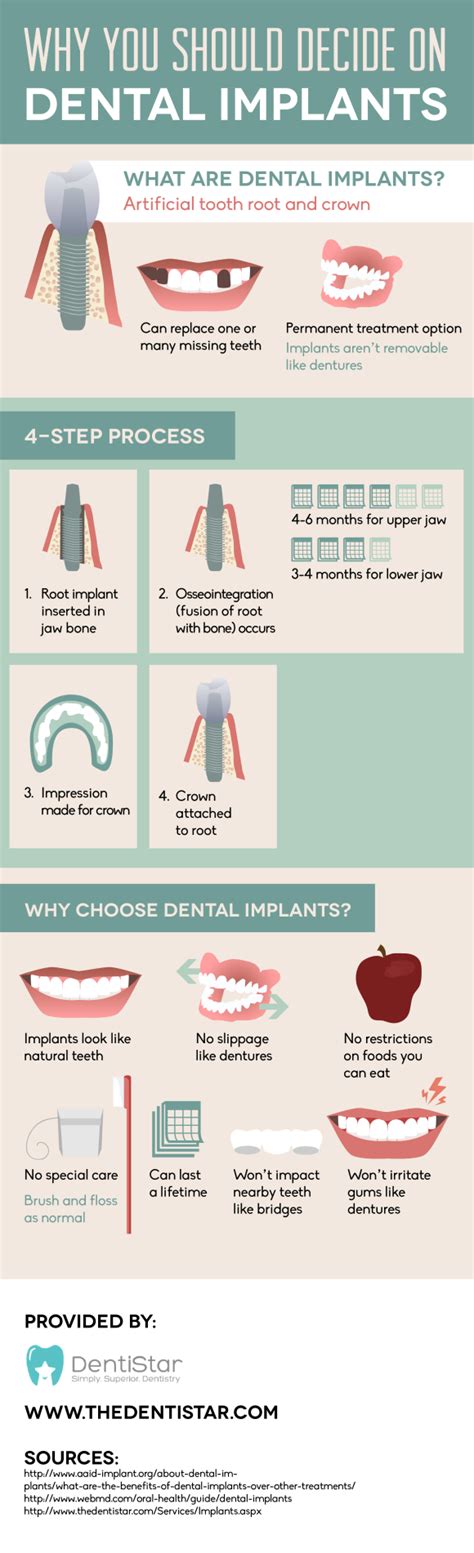 Why You Should Decide On Dental Implants INFOGRAPHIC