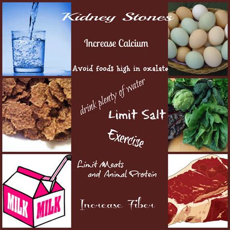 Kidney Stone Prevention - Steroids Live
