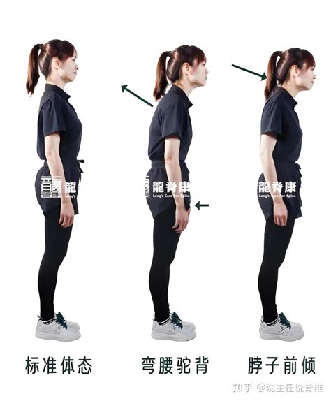 脖子后面的“富贵包”，是怎么长出来的？如何消除它？ 知乎