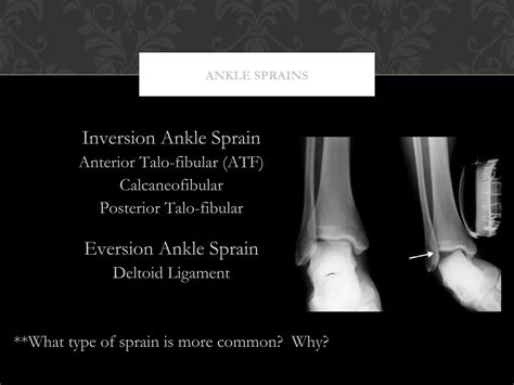 Foot, ankle, lower leg s12 | PPT