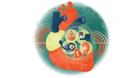 Heart Failure Medical Journeys Medpage Today