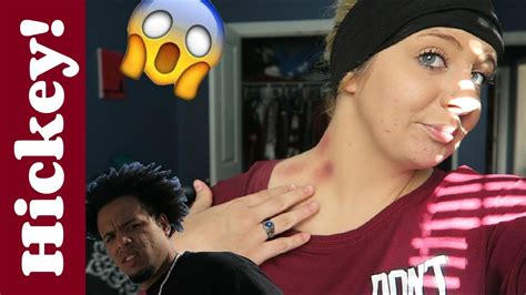 Hickey Prank On Boyfriend Gone Wrong Youtube