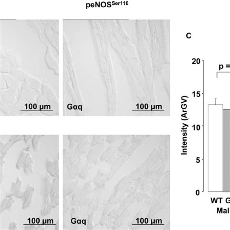 Immunohistochemical Staining Of Enos Phosphorylation At Serine 1177 In Download Scientific