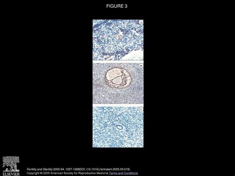 Expression Of Basic Fibroblast Growth Factor And Its Receptors In Human