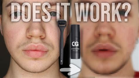 Do Facial Hair Growth Kits Really Work For Transmen Cg Review Youtube