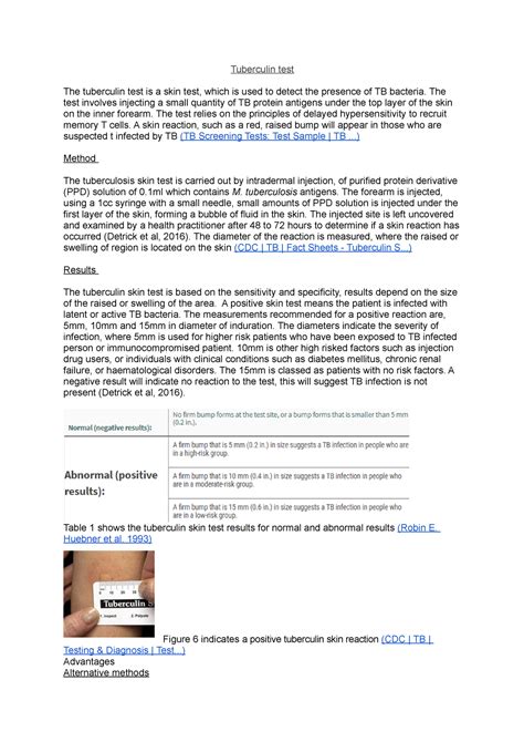This article explains how to interpret tuberculin test positive images 1