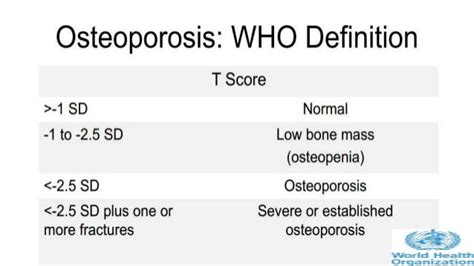 Osteoporosis Update Diagnosis And Management From Aafp Nof Aace Upt