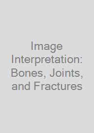 Image Interpretation Bones Joints And Fractures