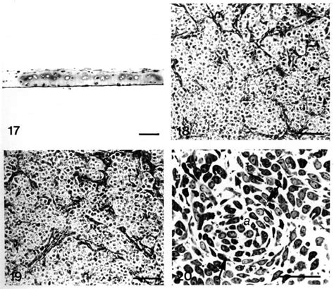 Transverse Section Through A Scleral Chondrocyteepiphyseal Chondrocyte