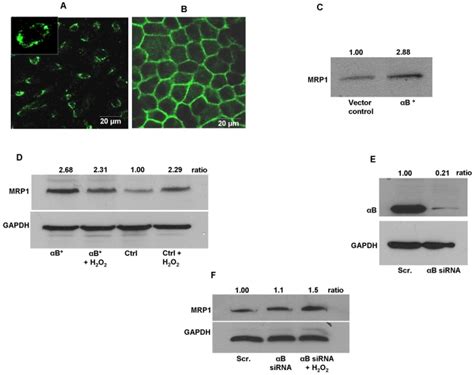 Arpe Cells A And Polarized Rpe Monolayer From Fetal Human Rpe