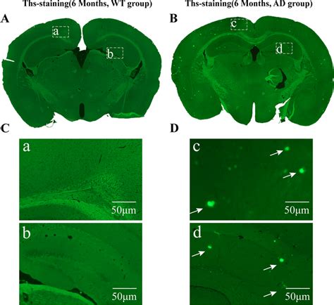 The Deposition Of Aβ Plaques In App Ps1 Mice At The 6th Month A B The