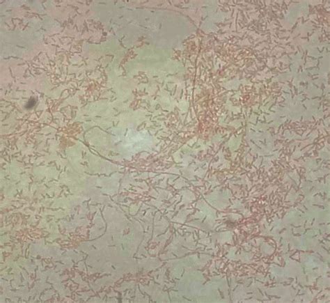 Pathology Outlines - Legionella