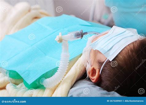 Little Boy Is Under General Anesthesia A Breathing Tube In The Baby