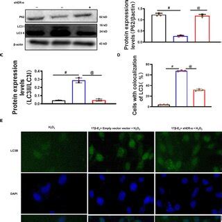 Knockdown of ER α inhibits 17β E2 mediated autophagy in HUVEC HUVECs