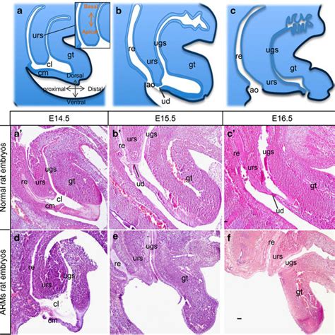 Descent Of The Urorectal Septum And Regression Of The Cloaca Membrane