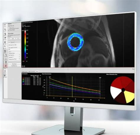 Software M Dico Hospitalar Pie Medical Imaging Cl Nico Para Rm