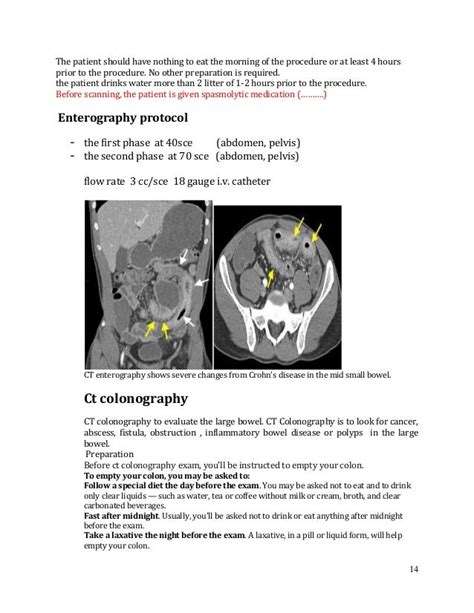 Ct Contrast Protocol And Abdomen Protocol Pdf