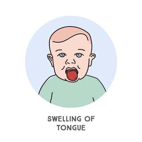 Cherry Allergy Swollen Tongue at Mike Fahey blog