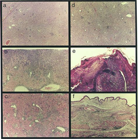 Histopathology Of L Major Infected Mice At Day 42 After Infection