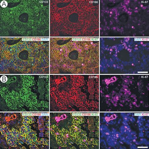 Series Of Multiple Fluorescence Immunohistochemistry CD133 Green