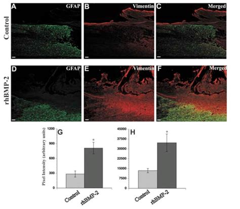 GFAP And Vimentin Immunolabeling Are Increased In The Spinal Cord Of